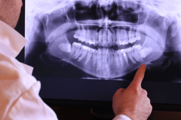 Best Dentist for Tooth Abscess  in West Pasco, WA