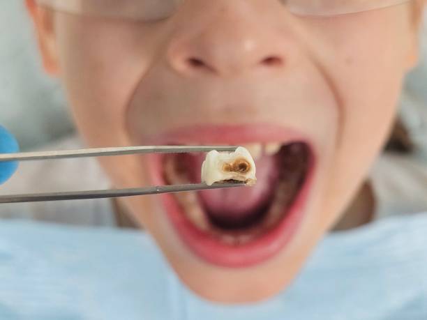 Best Emergency Pediatric Dentist  in West Pasco, WA
