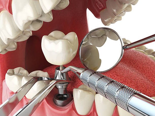 Emergency Gum Pain Relief in WA